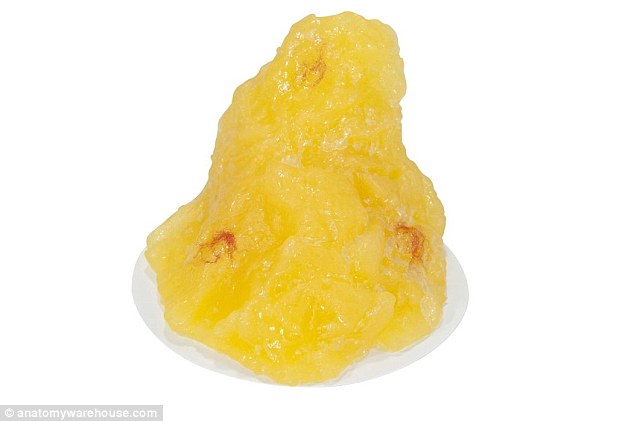 英网站出售人体油脂仿造品助力胖人节食减肥