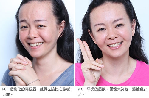 真人示范改善戏剧化的高低眉_整形