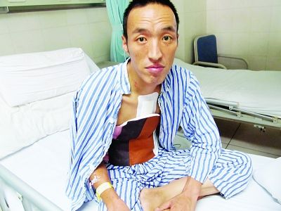 37岁男子血液呈紫色 粘稠如浆糊针筒抽不出