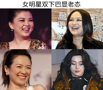 它的出现主要还是由于脂肪在作怪,医学上称双下巴为下颌脂肪袋