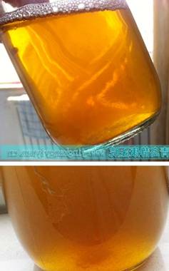 母亲细细观察儿子的尿液后,告诉他这就是堆积在肾脏的毒素,愁容满面的