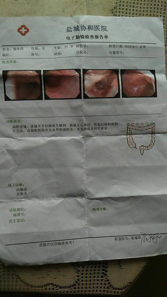 下腹痛腹胀
