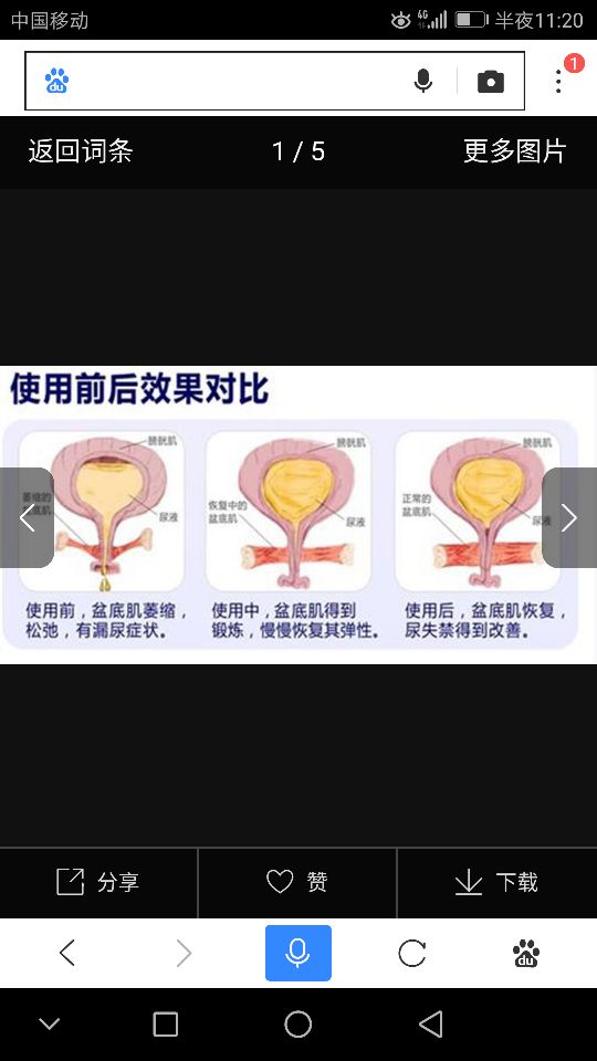 顺产42天去复查盆底肌肉松了