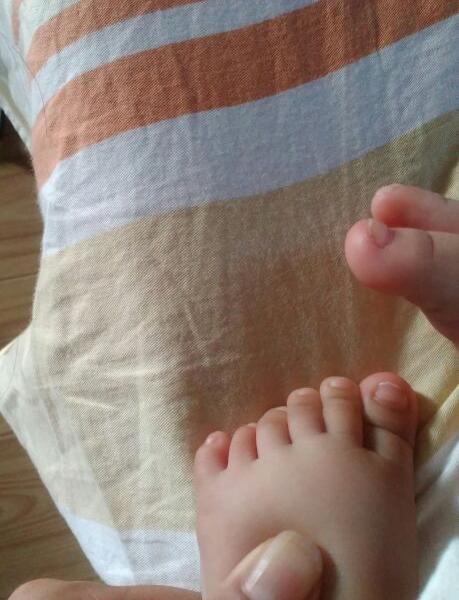 宝宝6个脚趾头.