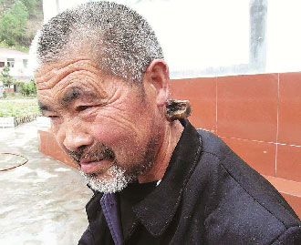 老人脖子上长出一只“角” 生长35年每年锯2次