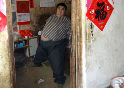 600斤中国首胖死亡 重度肥胖怎么减肥