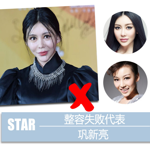 李小璐郑爽熊乃瑾 明星整容失败vs成功案例