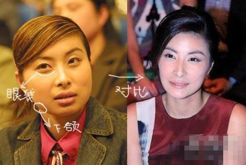 整容细节被曝光 被“指旺夫”相造假