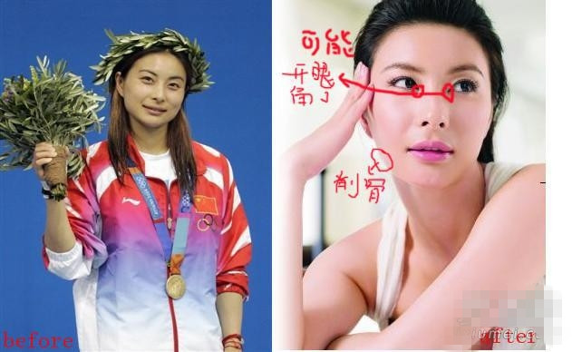 整容细节被曝光 被“指旺夫”相造假