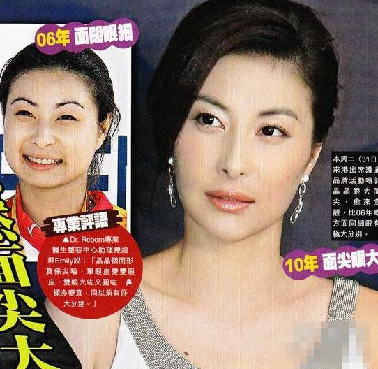 整容细节被曝光 被“指旺夫”相造假