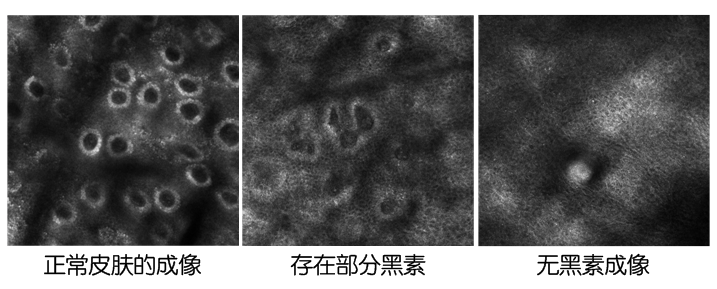 neirong1