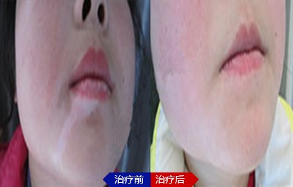 u497