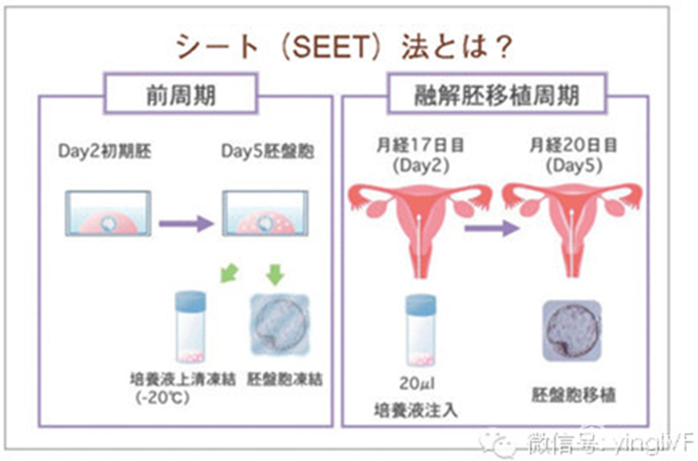 胚胎移植原理是什么_胚胎是什么样子的图片