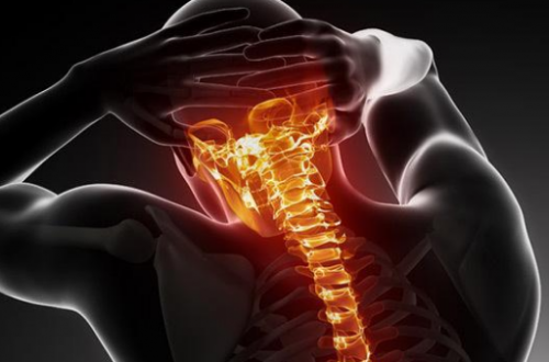 颈椎痛怎么缓解?氨糖软骨素+多种锻炼方式帮