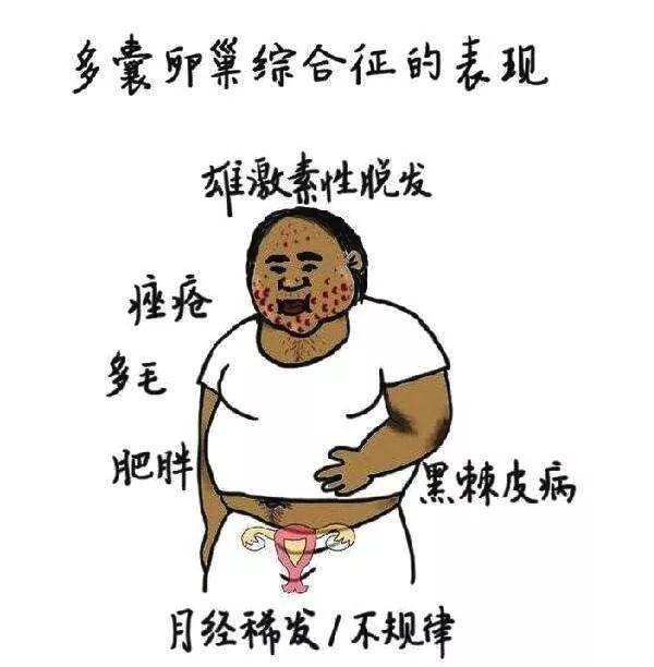 深圳怡康妇产医院正规吗关于多囊卵巢综合征的5大误解有必要了解一下