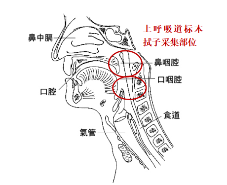 比如用口咽拭子,鼻咽拭子同时采集标本,然后放到同一采集管中送检.