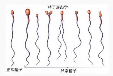 精子不液化