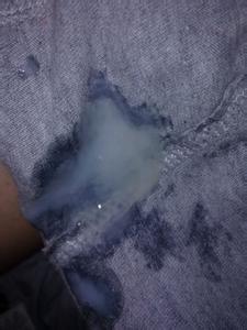 精子不液化