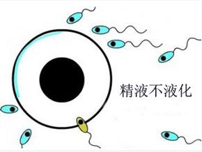 精子不液化