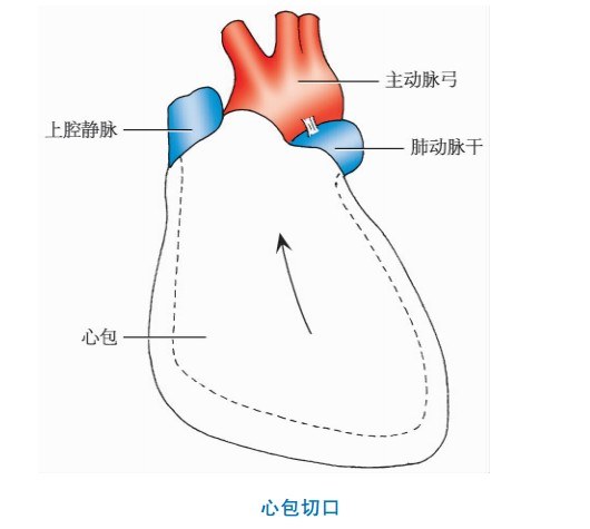 升主动脉和肺动脉的后面与上腔静脉和左心房的前面之间,探查心包横窦
