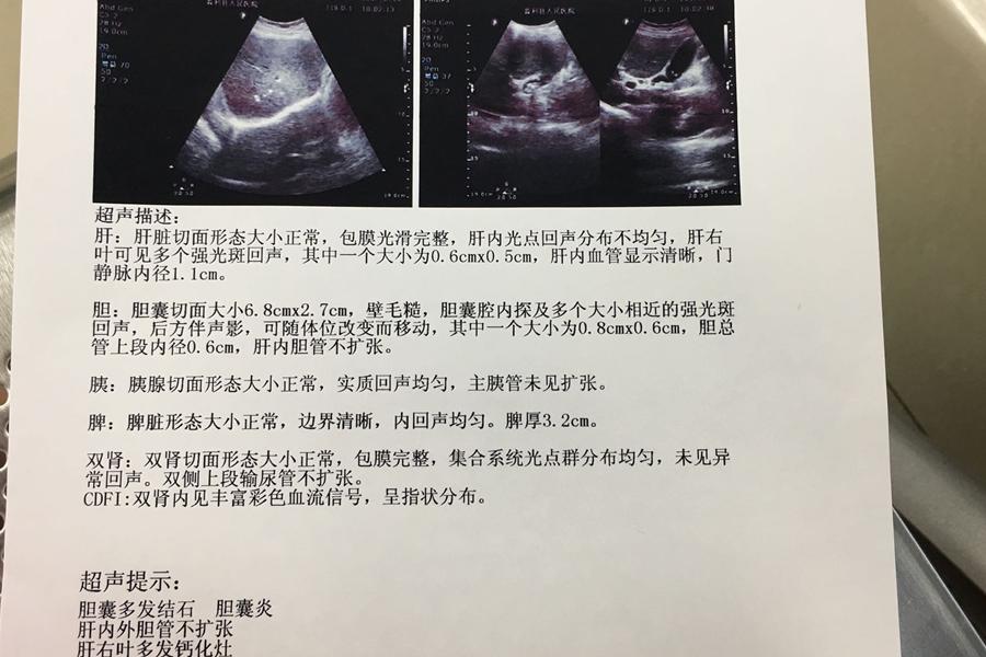 检查肝是做b超还是ct好,为什么?