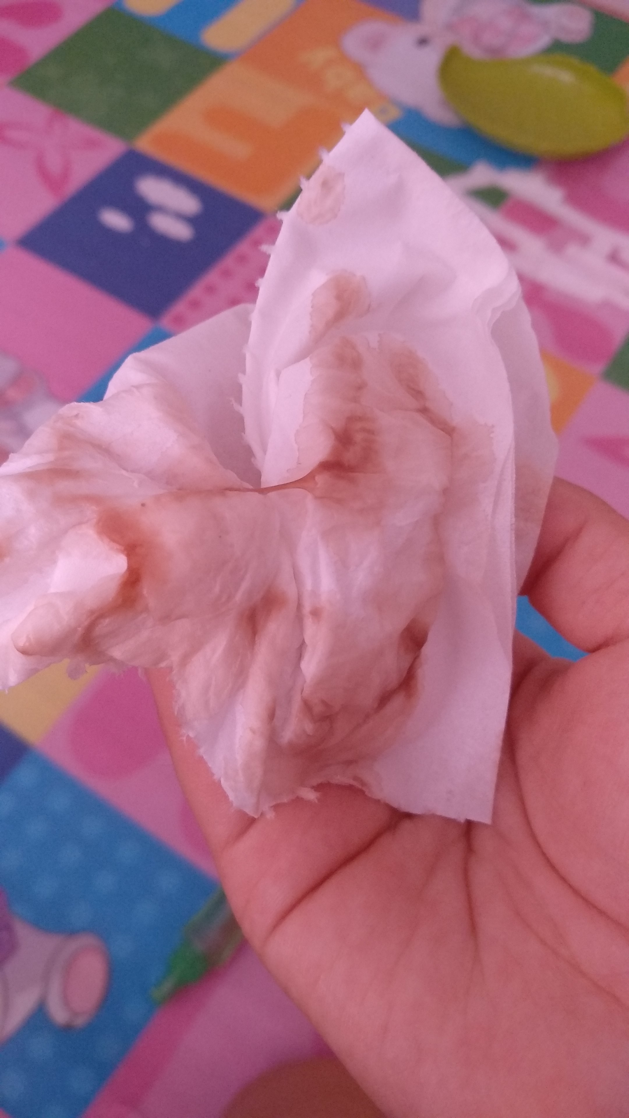 月经干净后一天,第二天又有褐色的分泌物