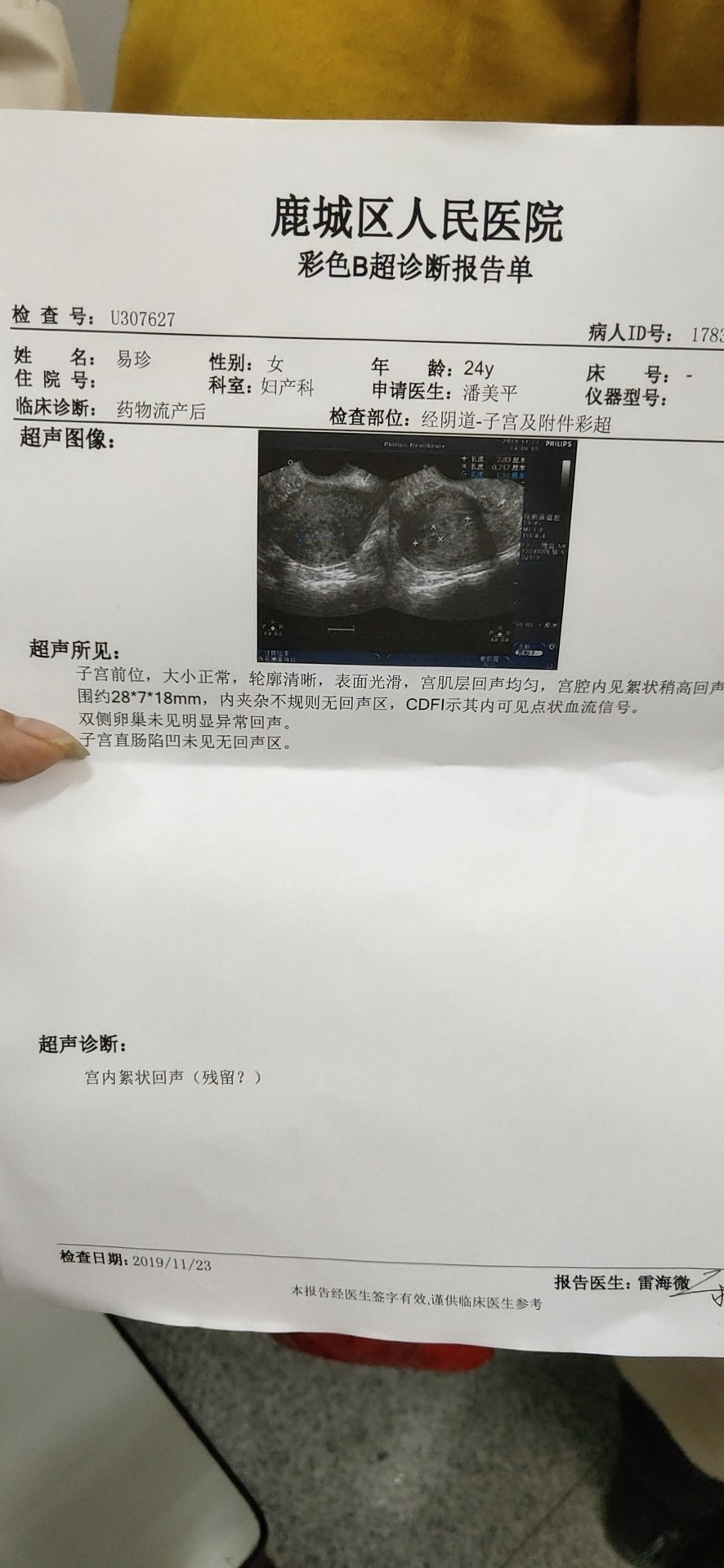 描述:11月8号做的药流,到今天半个月了,现在还有褐色分泌物排除一点点