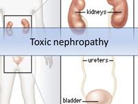 中毒性肾病