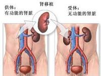 中毒性肾病