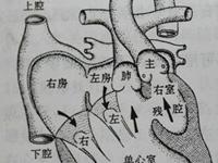 单心室
