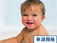 小儿高血压