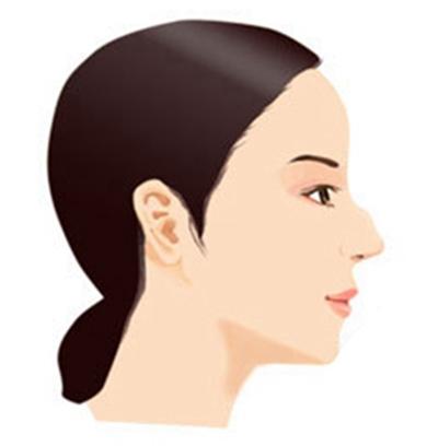 鹰钩鼻