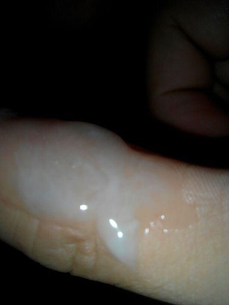 精液稠