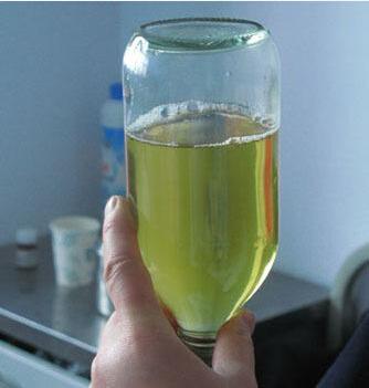 尿泡沫