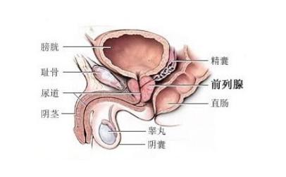 前列腺增生