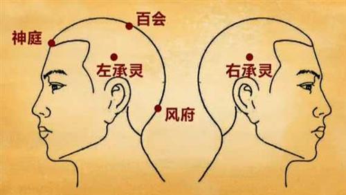 神经性头痛