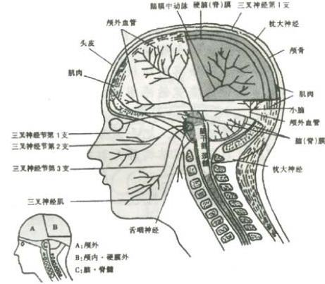 神经性头痛