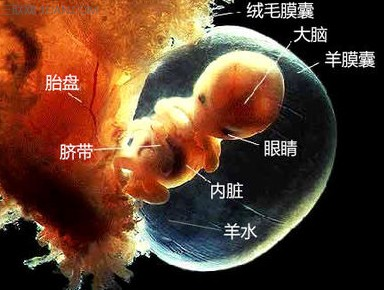 羊水过多