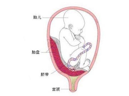 胎盘前置