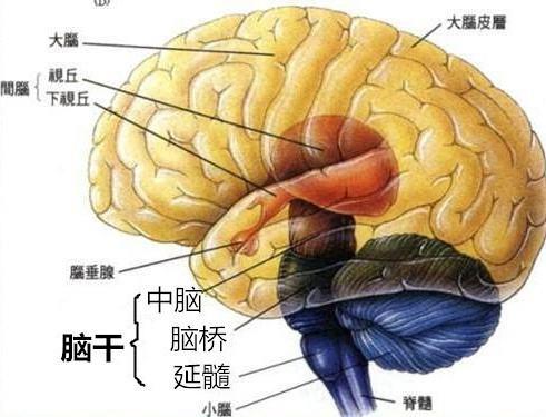 脑干出血
