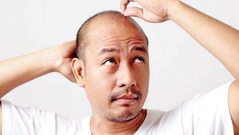 毛发脱落
