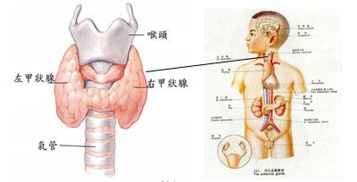 甲状腺肿