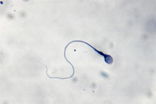 精子活力低