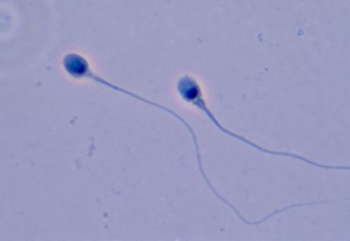 精子活力低