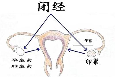 继发性闭经