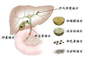 肝部疼痛
