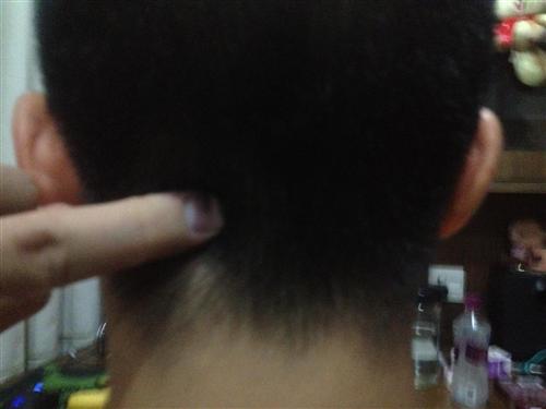后脑勺疼
