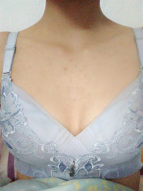 胸部下垂