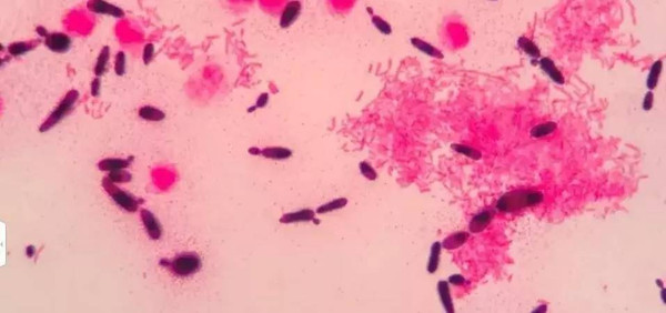 革兰阴性杆菌感染
