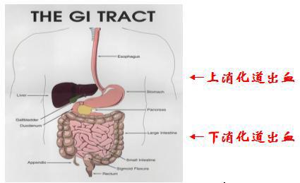 上消化道出血